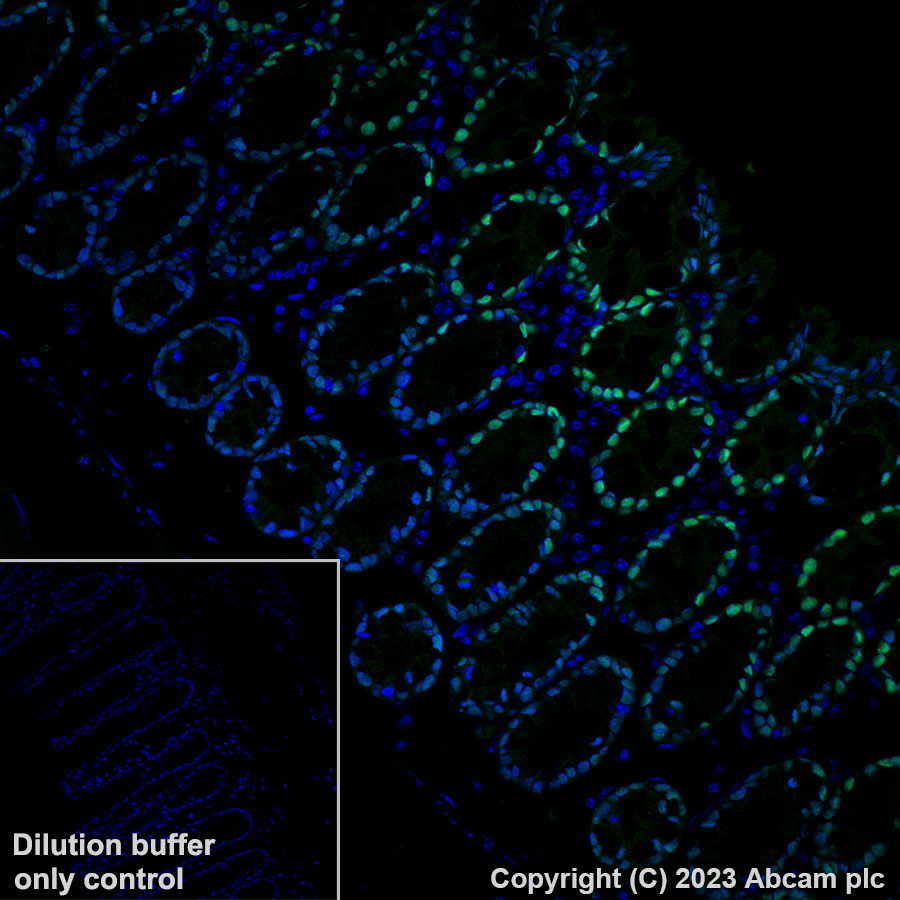 Immunohistochemistry (Formalin/PFA-fixed paraffin-embedded sections) - Alexa Fluor® 488 Anti-CDX2 antibody [EPR2764Y] (AB195007), expandable thumbnail