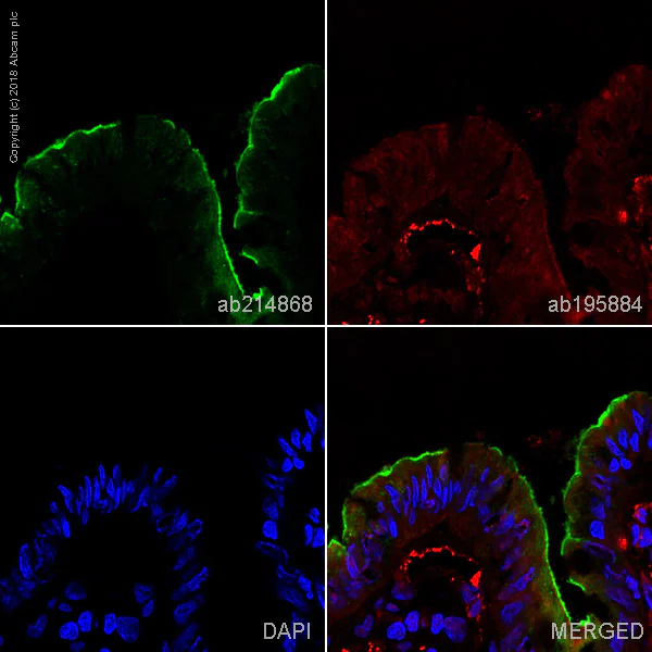 Immunohistochemistry (Frozen sections) - Alexa Fluor® 488 Anti-CEACAM5 antibody [EPCEAR7] (AB214868)