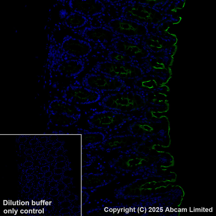 Immunohistochemistry (Formalin/PFA-fixed paraffin-embedded sections) - Alexa Fluor® 488 Anti-CEACAM5 antibody [EPR28723-86] (AB323891), expandable thumbnail