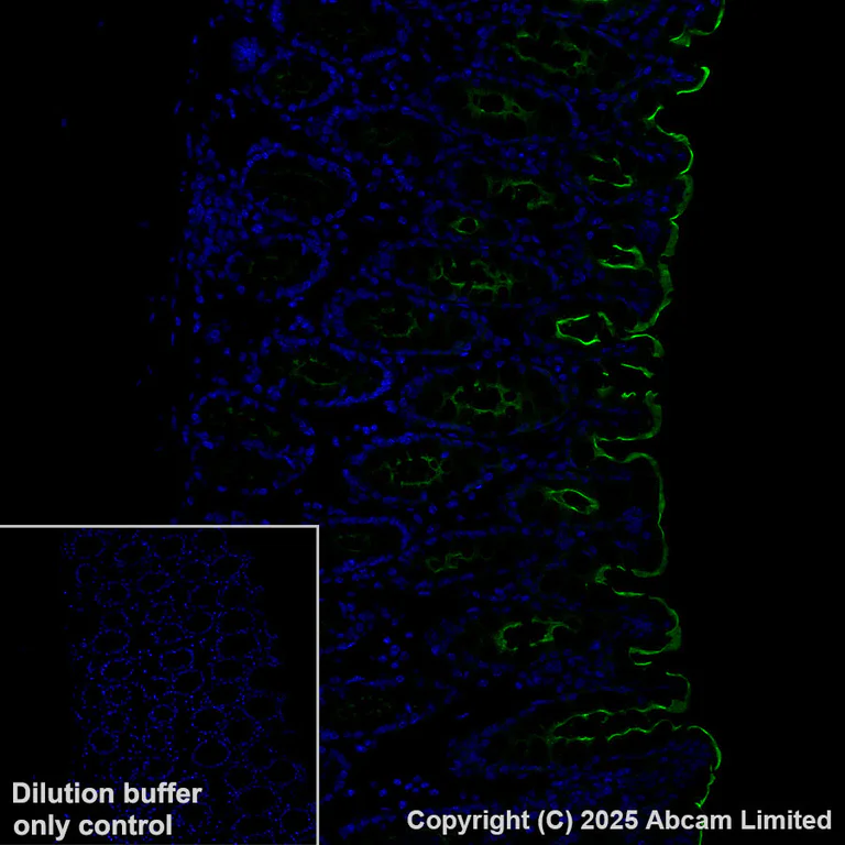 Immunohistochemistry (Formalin/PFA-fixed paraffin-embedded sections) - Alexa Fluor® 488 Anti-CEACAM5 antibody [EPR28723-86] (AB323891)