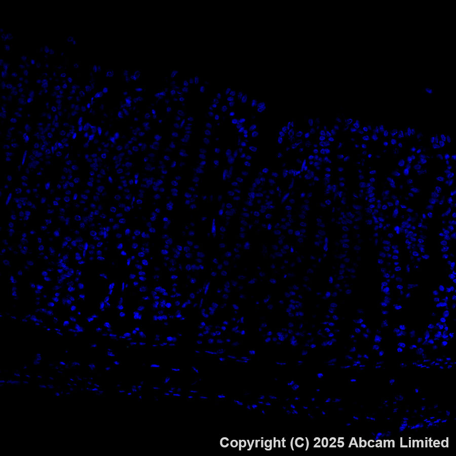 Immunohistochemistry (Formalin/PFA-fixed paraffin-embedded sections) - Alexa Fluor® 488 Anti-CEACAM5 antibody [EPR28723-86] (AB323891), expandable thumbnail
