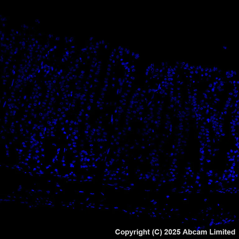 Immunohistochemistry (Formalin/PFA-fixed paraffin-embedded sections) - Alexa Fluor® 488 Anti-CEACAM5 antibody [EPR28723-86] (AB323891)