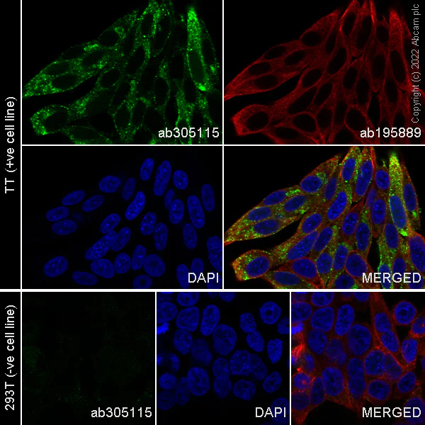 Immunocytochemistry/ Immunofluorescence - Alexa Fluor® 488 Anti-CGRP-I+CGRP-II antibody [EPR23804-95] (AB305115)