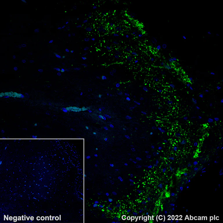 Immunohistochemistry (Formalin/PFA-fixed paraffin-embedded sections) - Alexa Fluor® 488 Anti-CGRP-I+CGRP-II antibody [EPR23804-95] (AB305115)