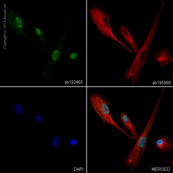 Immunocytochemistry/ Immunofluorescence - Alexa Fluor® 488 Anti-Choline Acetyltransferase antibody [EPR13024(B)] (AB192465), expandable thumbnail