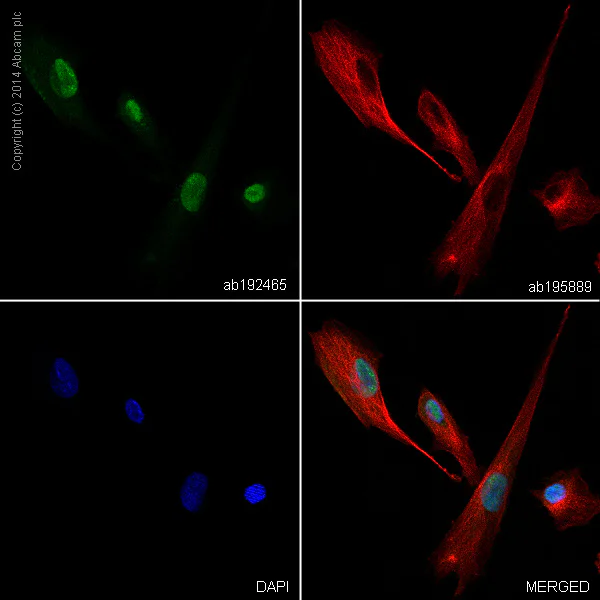 Immunocytochemistry/ Immunofluorescence - Alexa Fluor® 488 Anti-Choline Acetyltransferase antibody [EPR13024(B)] (AB192465)