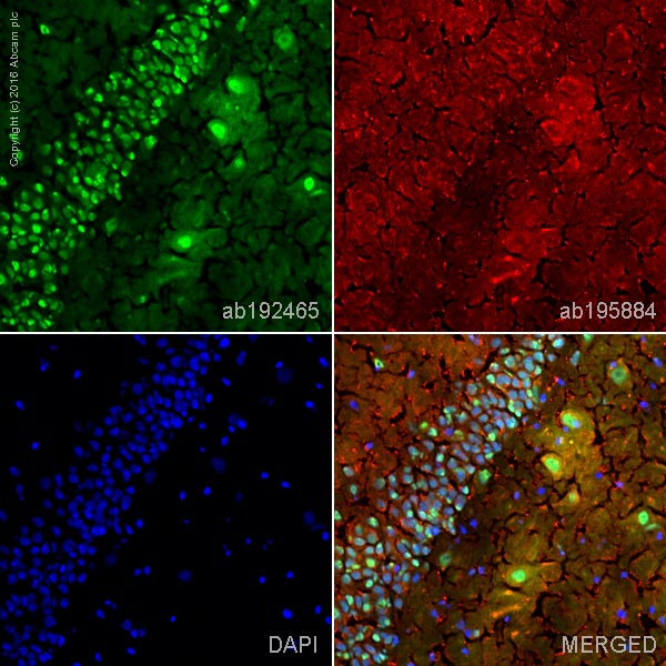 Immunohistochemistry (Frozen sections) - Alexa Fluor® 488 Anti-Choline Acetyltransferase antibody [EPR13024(B)] (AB192465), expandable thumbnail