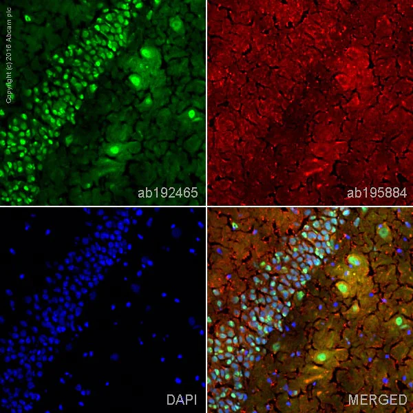 Immunohistochemistry (Frozen sections) - Alexa Fluor® 488 Anti-Choline Acetyltransferase antibody [EPR13024(B)] (AB192465)