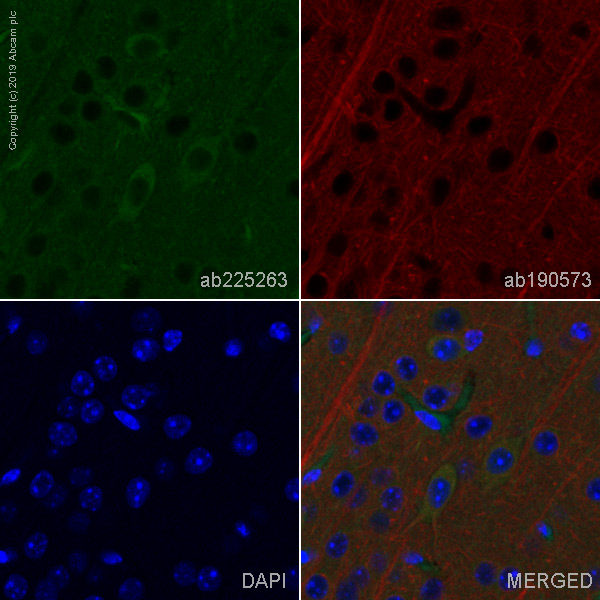 Immunohistochemistry (Formalin/PFA-fixed paraffin-embedded sections) - Alexa Fluor® 488 Anti-Choline Acetyltransferase antibody [EPR16590] (AB225263), expandable thumbnail