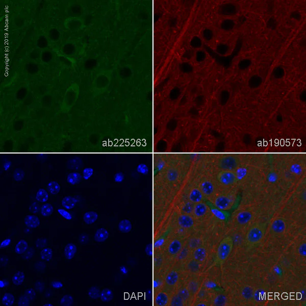 Immunohistochemistry (Formalin/PFA-fixed paraffin-embedded sections) - Alexa Fluor® 488 Anti-Choline Acetyltransferase antibody [EPR16590] (AB225263)