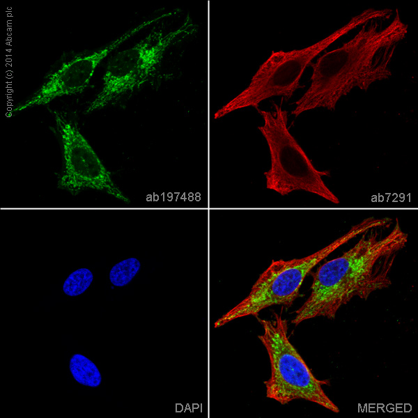 Immunocytochemistry/ Immunofluorescence - Alexa Fluor® 488 Anti-Citrate synthetase antibody [EPR8067] (AB197488), expandable thumbnail