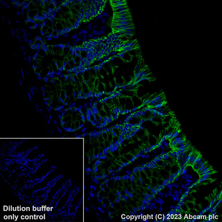 Immunohistochemistry (Formalin/PFA-fixed paraffin-embedded sections) - Alexa Fluor® 488 Anti-Claudin 1 antibody [EPR25359-48] (AB315954)