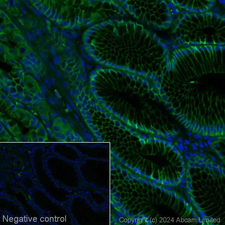 Anti-Claudin 18.2 Alexa Fluor® 488 antibody [EPR19202] (ab311014