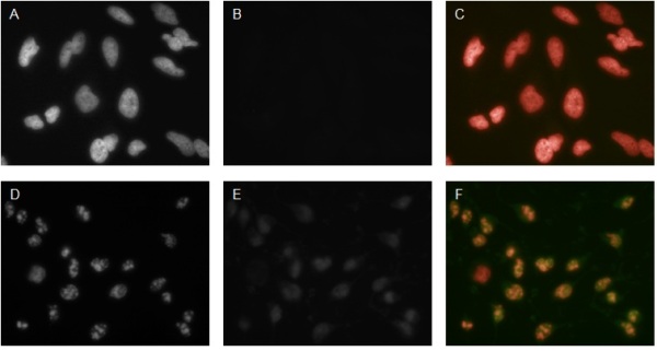 Immunocytochemistry - Alexa Fluor® 488 Anti-Cleaved PARP1 antibody [4B5BD2] (AB170171), expandable thumbnail
