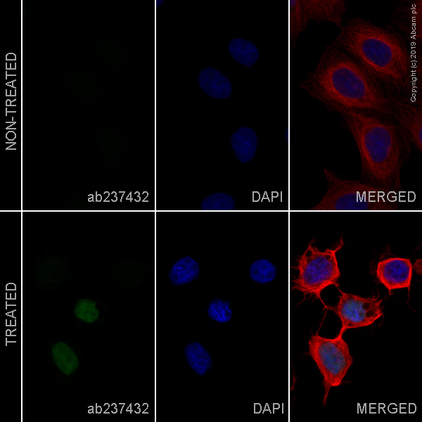 Immunocytochemistry/ Immunofluorescence - Alexa Fluor® 488 Anti-Cleaved PARP1 antibody [Y34] (AB237432)