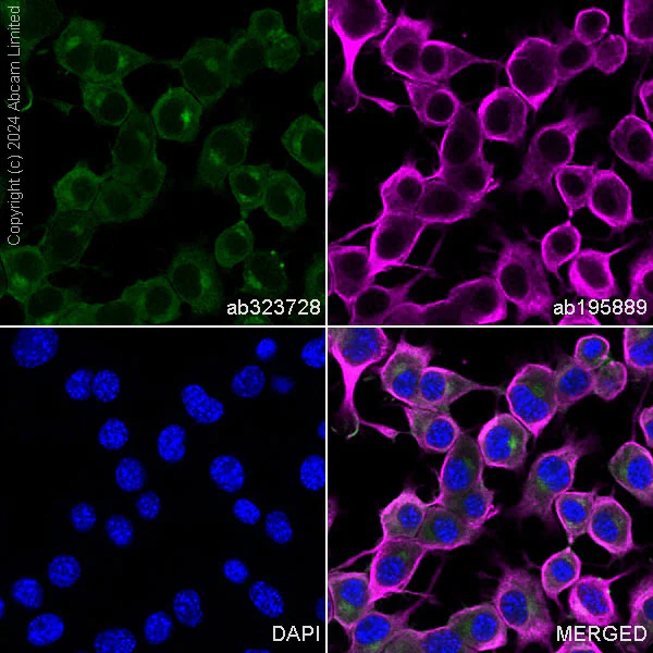 Immunocytochemistry/ Immunofluorescence - Alexa Fluor® 488 Anti-CMKLR1 antibody [EPR26501-70] (AB323728)
