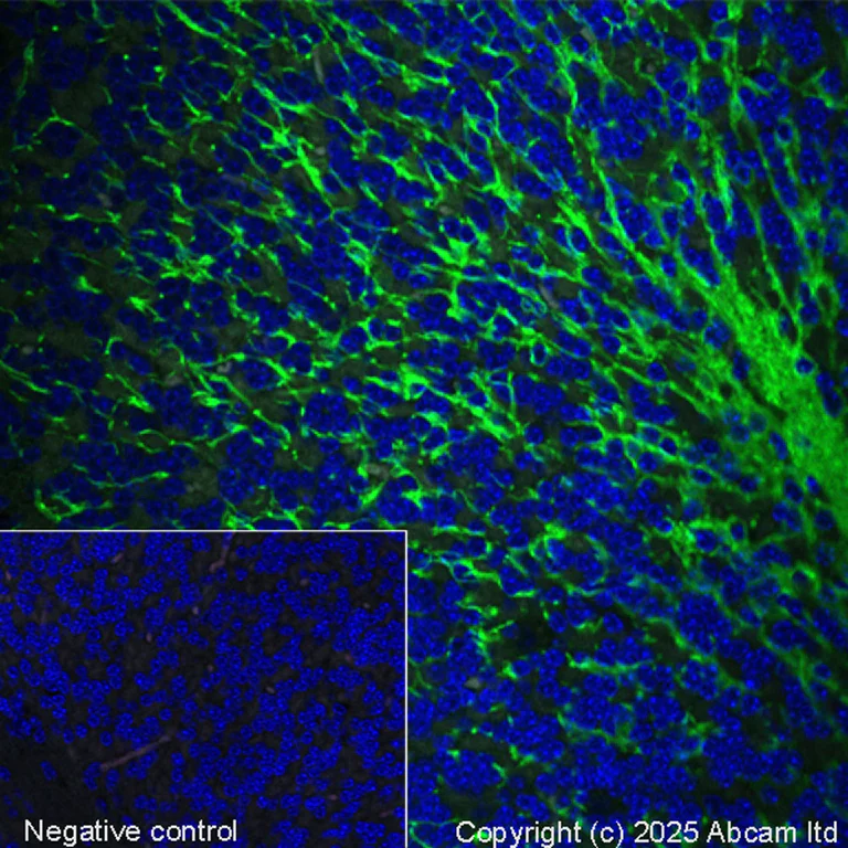 Immunohistochemistry (Formalin/PFA-fixed paraffin-embedded sections) - Alexa Fluor® 488 Anti-CNPase antibody [11-5B] (AB313960)