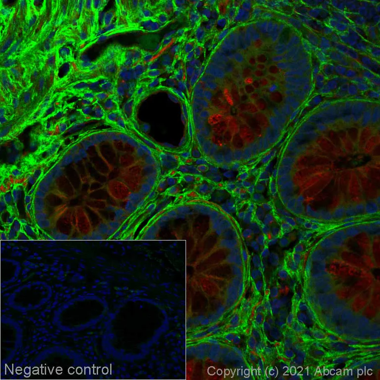 Immunohistochemistry (Formalin/PFA-fixed paraffin-embedded sections) - Alexa Fluor® 488 Anti-COL1A2 antibody [EPR24262-52] (AB281761)