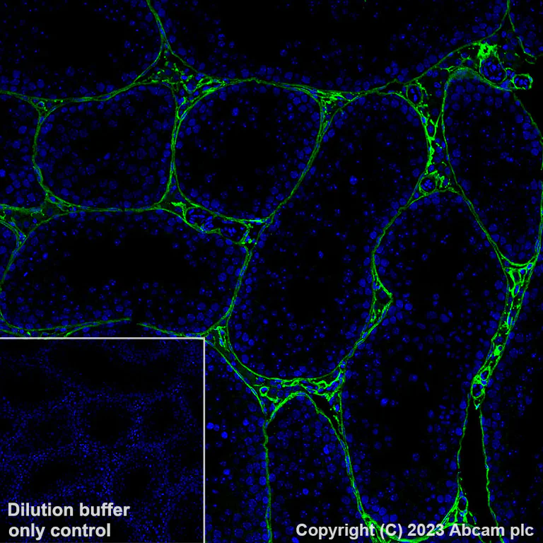 Immunohistochemistry (Formalin/PFA-fixed paraffin-embedded sections) - Alexa Fluor® 488 Anti-Collagen I antibody [EPR24331-53] (AB309248)