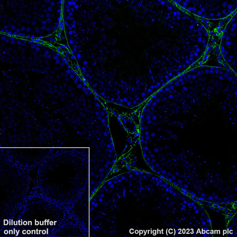 Immunohistochemistry (Formalin/PFA-fixed paraffin-embedded sections) - Alexa Fluor® 488 Anti-Collagen I antibody [EPR24331-53] (AB309248)
