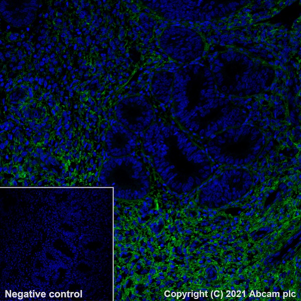 Alexa Fluor 488 Anti-Collagen I antibody [EPR7785]