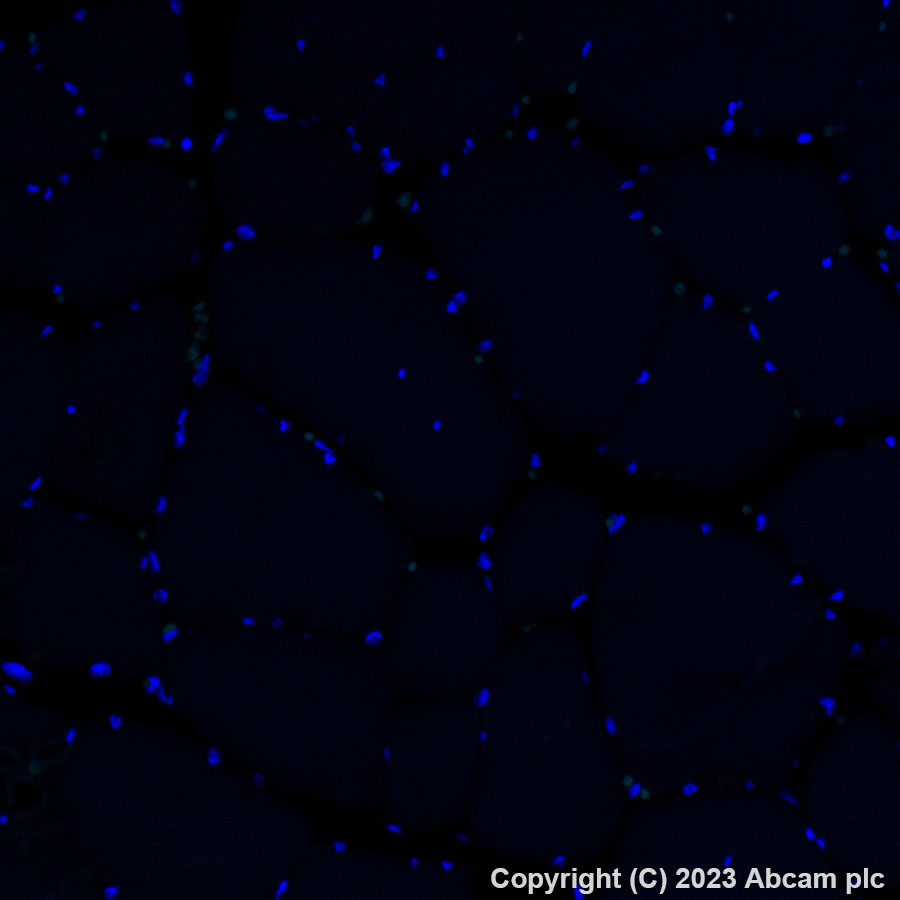 Immunohistochemistry (Formalin/PFA-fixed paraffin-embedded sections) - Alexa Fluor® 488 Anti-Collagen IV antibody [EPR22911-127] (AB309502), expandable thumbnail