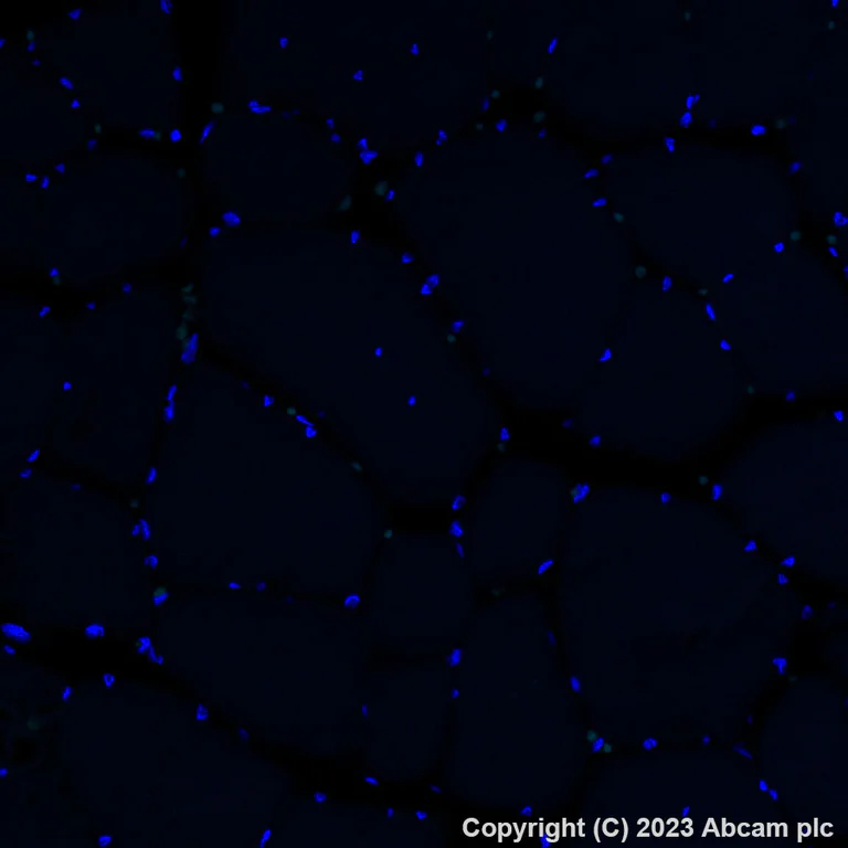 Immunohistochemistry (Formalin/PFA-fixed paraffin-embedded sections) - Alexa Fluor® 488 Anti-Collagen IV antibody [EPR22911-127] (AB309502)