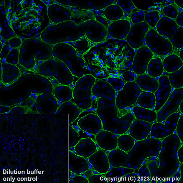 Immunohistochemistry (Formalin/PFA-fixed paraffin-embedded sections) - Alexa Fluor® 488 Anti-Collagen IV antibody [EPR22911-127] (AB309502)
