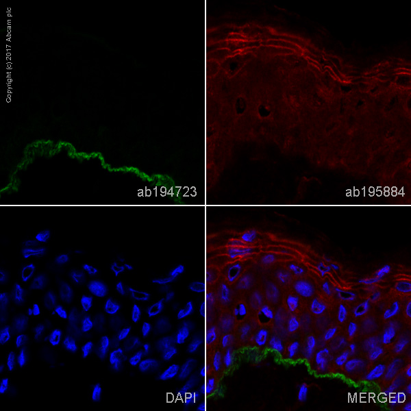 Immunohistochemistry (Frozen sections) - Alexa Fluor® 488 Anti-Collagen XVII antibody [EPR14758] (AB194723)