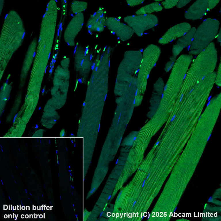 Immunohistochemistry (Formalin/PFA-fixed paraffin-embedded sections) - Alexa Fluor® 488 Anti-COMP/Cartilage oligomeric matrix protein antibody [EPR25364-6] (AB325042)