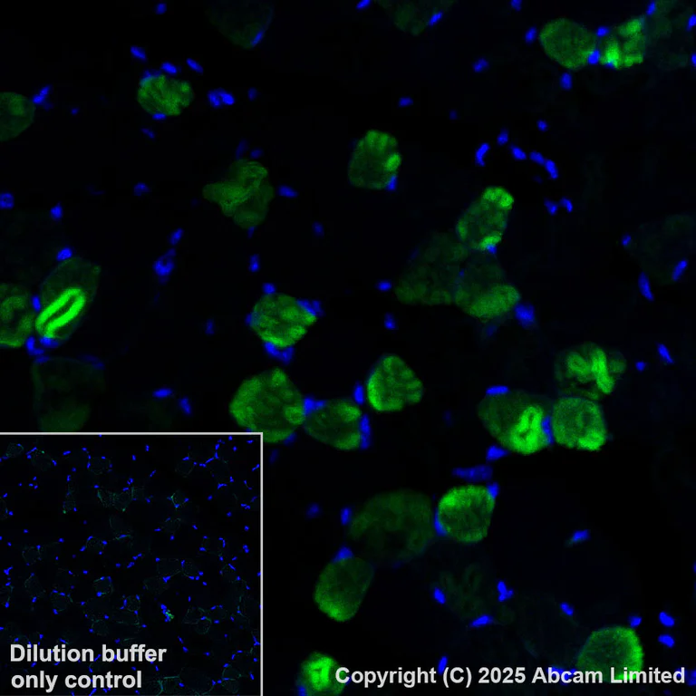Immunohistochemistry (Formalin/PFA-fixed paraffin-embedded sections) - Alexa Fluor® 488 Anti-COMP/Cartilage oligomeric matrix protein antibody [EPR25364-6] (AB325042)
