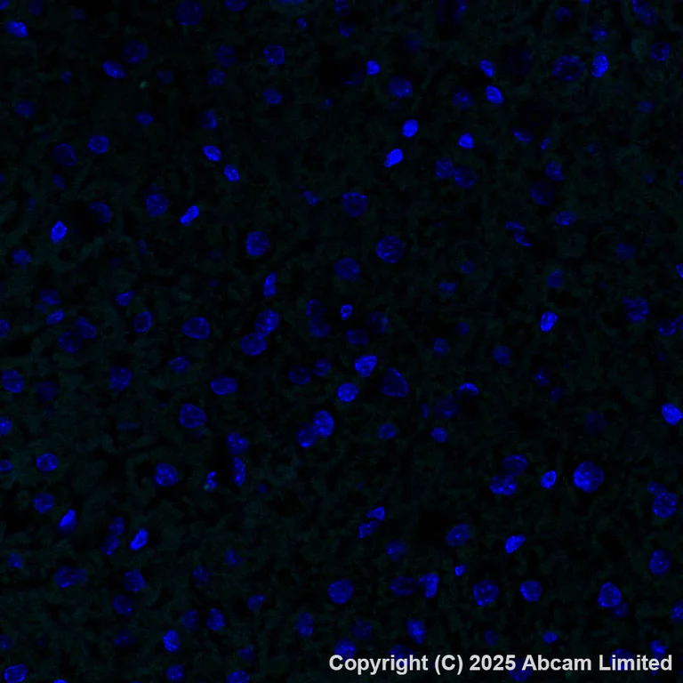 Immunohistochemistry (Formalin/PFA-fixed paraffin-embedded sections) - Alexa Fluor® 488 Anti-COMP/Cartilage oligomeric matrix protein antibody [EPR25364-6] (AB325042)