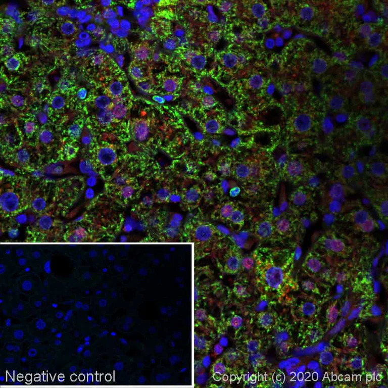 Immunohistochemistry (Formalin/PFA-fixed paraffin-embedded sections) - Alexa Fluor® 488 Anti-CPS1 antibody [EPR7493-3] (AB252114)