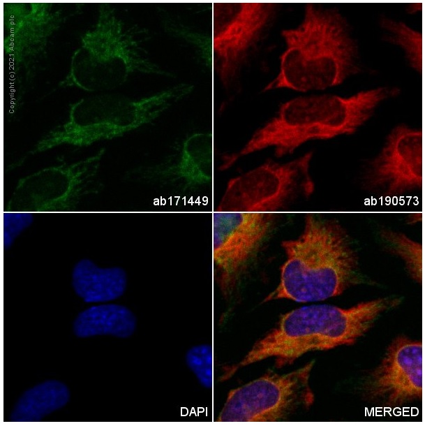 Immunocytochemistry/ Immunofluorescence - Alexa Fluor® 488 Anti-CPT1A antibody [8F6AE9] (AB171449), expandable thumbnail