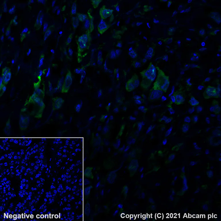 Immunohistochemistry (Formalin/PFA-fixed paraffin-embedded sections) - Alexa Fluor® 488 Anti-CTAG1B antibody [EPR13780] (AB281932)