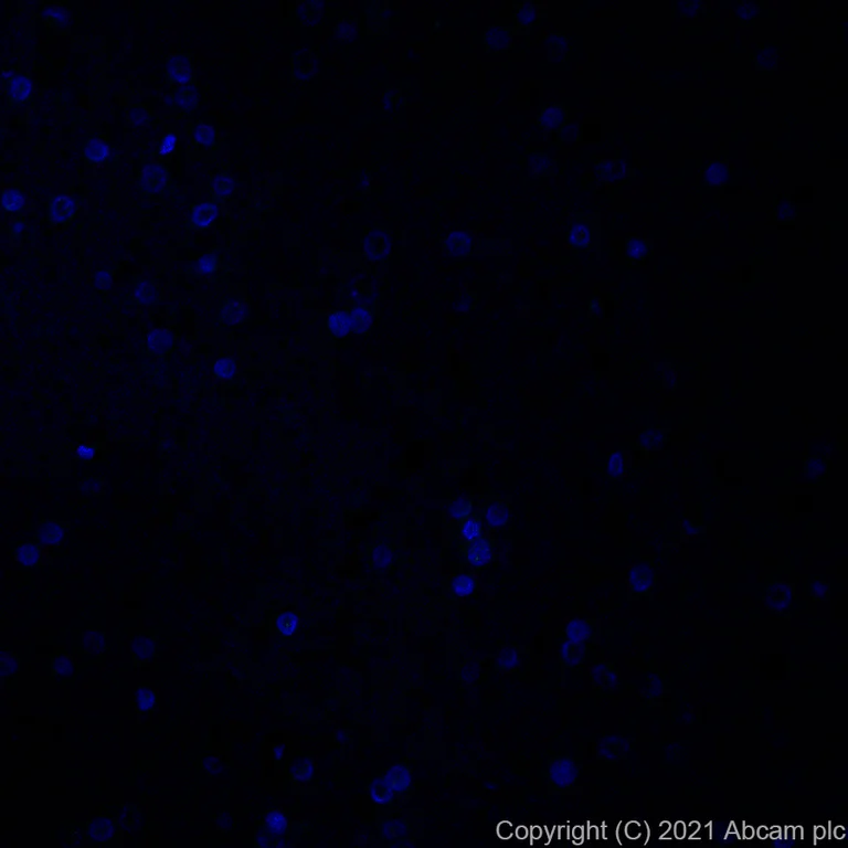 Immunohistochemistry (Formalin/PFA-fixed paraffin-embedded sections) - Alexa Fluor® 488 Anti-CTAG1B antibody [EPR13780] (AB281932)