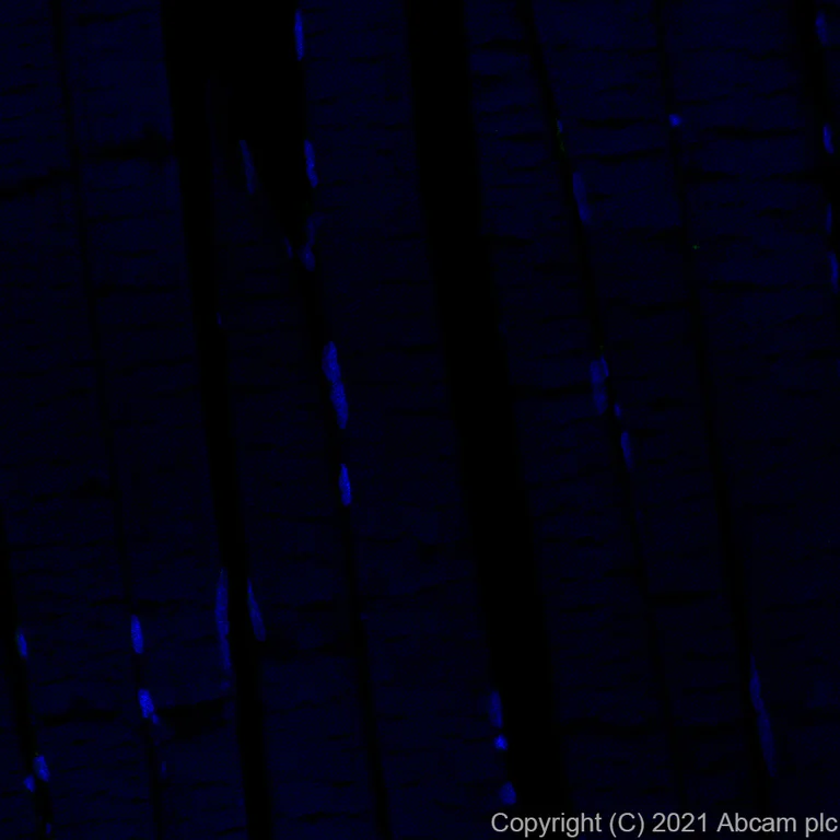 Immunohistochemistry (Formalin/PFA-fixed paraffin-embedded sections) - Alexa Fluor® 488 Anti-CTAG1B antibody [EPR13780] (AB281932)