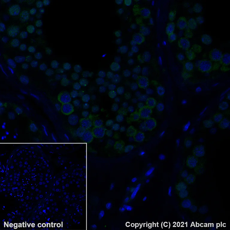 Immunohistochemistry (Formalin/PFA-fixed paraffin-embedded sections) - Alexa Fluor® 488 Anti-CTAG1B antibody [EPR13780] (AB281932)
