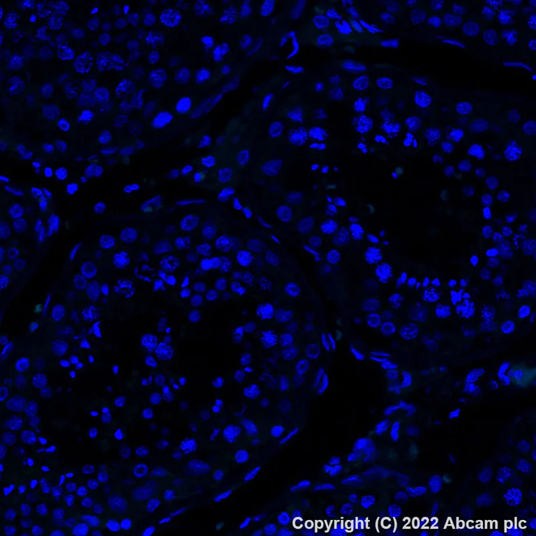 Immunohistochemistry (Formalin/PFA-fixed paraffin-embedded sections) - Alexa Fluor® 488 Anti-CXCL9 antibody [EPR26512-118] (AB308597)