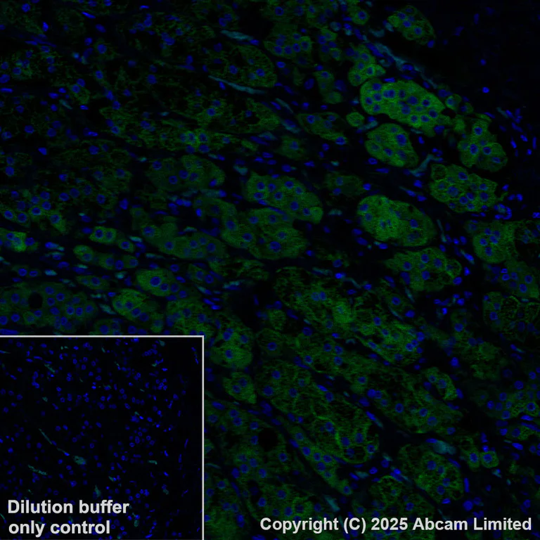 Immunohistochemistry (Formalin/PFA-fixed paraffin-embedded sections) - Alexa Fluor® 488 Anti-CYP21A2 antibody [EPR29787-27] (AB325700)