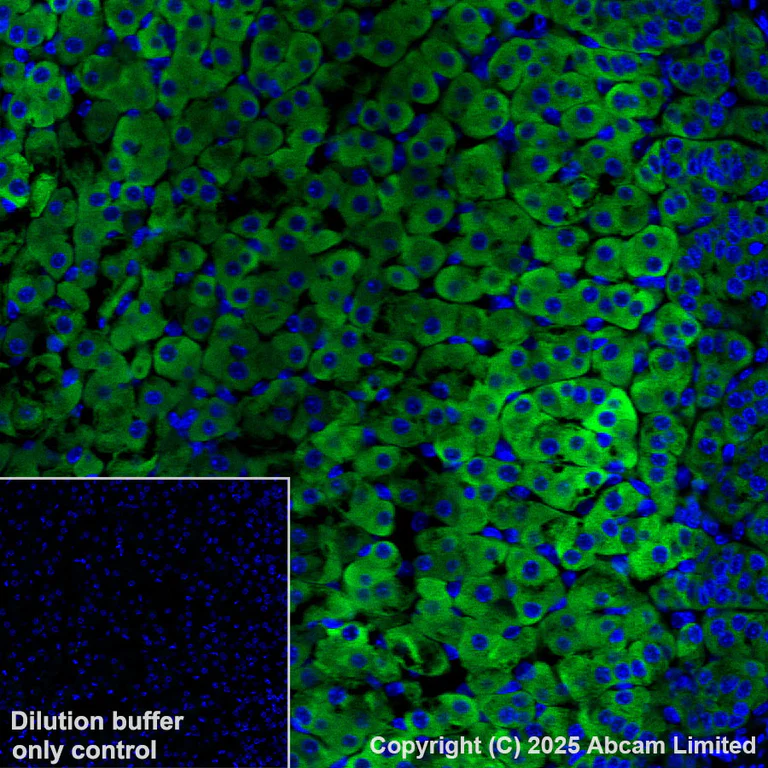 Immunohistochemistry (Formalin/PFA-fixed paraffin-embedded sections) - Alexa Fluor® 488 Anti-CYP21A2 antibody [EPR29787-27] (AB325700)