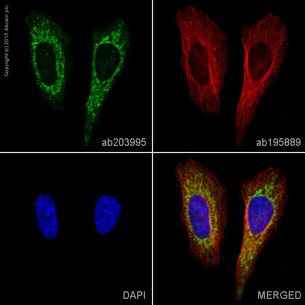 Immunocytochemistry/ Immunofluorescence - Alexa Fluor® 488 Anti-Cytochrome P450 17A1/CYP17A1 antibody [EPR6293] (AB203995)