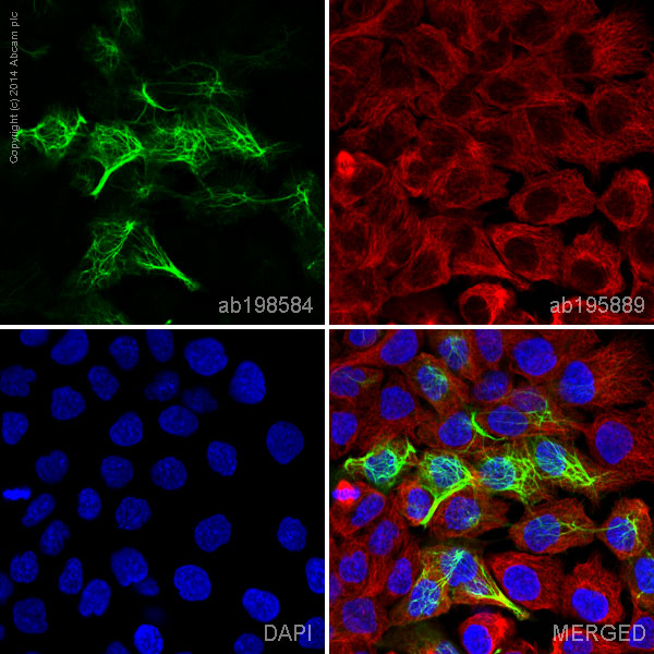 Immunocytochemistry/ Immunofluorescence - Alexa Fluor® 488 Anti-Cytokeratin 13 antibody [EPR3671] (AB198584), expandable thumbnail