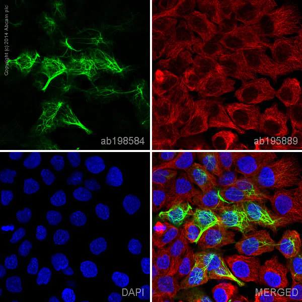 Immunocytochemistry/ Immunofluorescence - Alexa Fluor® 488 Anti-Cytokeratin 13 antibody [EPR3671] (AB198584)