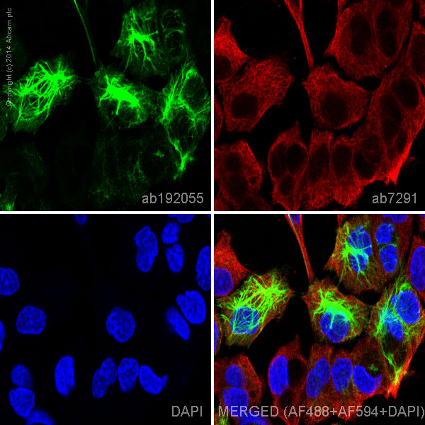 Immunocytochemistry/ Immunofluorescence - Alexa Fluor® 488 Anti-Cytokeratin 14 antibody [EP1612Y] (AB192055), expandable thumbnail