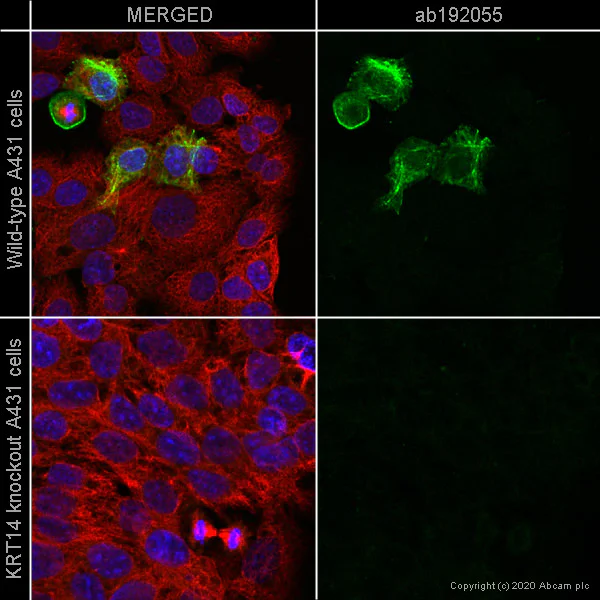 Immunocytochemistry/ Immunofluorescence - Alexa Fluor® 488 Anti-Cytokeratin 14 antibody [EP1612Y] (AB192055)