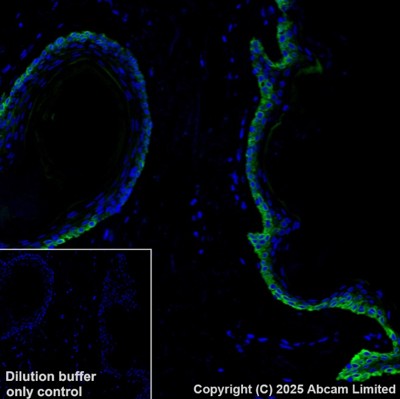 Anti-Cytokeratin 14 Alexa Fluor® 488 antibody [EP1612Y] (ab192055