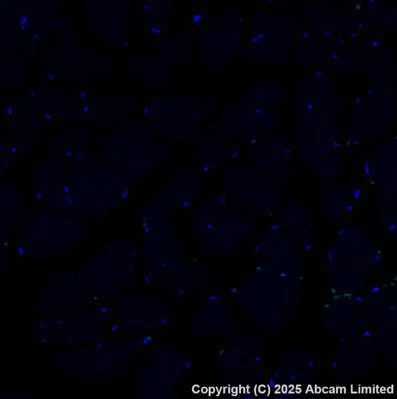 Immunohistochemistry (Formalin/PFA-fixed paraffin-embedded sections) - Alexa Fluor® 488 Anti-Cytokeratin 14 antibody [EP1612Y] (AB192055)