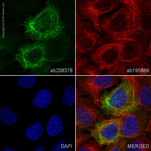 Immunocytochemistry/ Immunofluorescence - Alexa Fluor® 488 Anti-Cytokeratin 14 antibody [EPR1612] (AB208378)