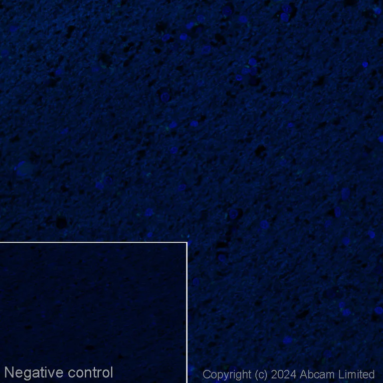 Immunohistochemistry (Formalin/PFA-fixed paraffin-embedded sections) - Alexa Fluor® 488 Anti-Cytokeratin 14 antibody [LL002] (AB320070)
